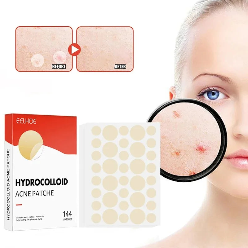 ClearSkin Rapid Invisible Spot Patches
